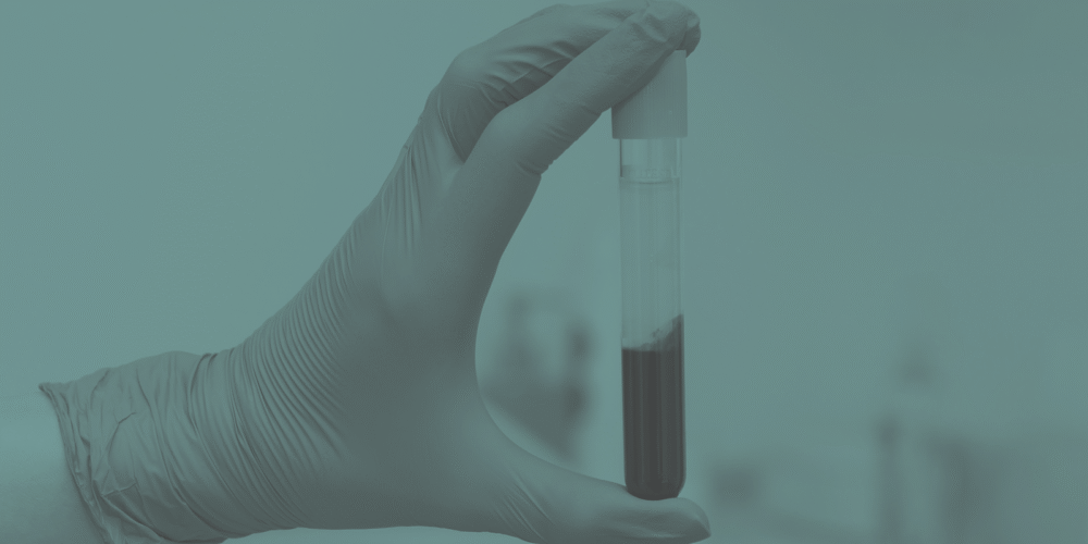 Sozo-Live-Blood-Analysis-Assessment