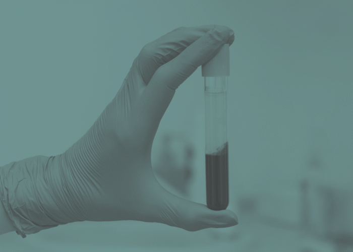 Sozo-Live-Blood-Analysis-Assessment Sozo-Live-Blood-Analysis-Assessment